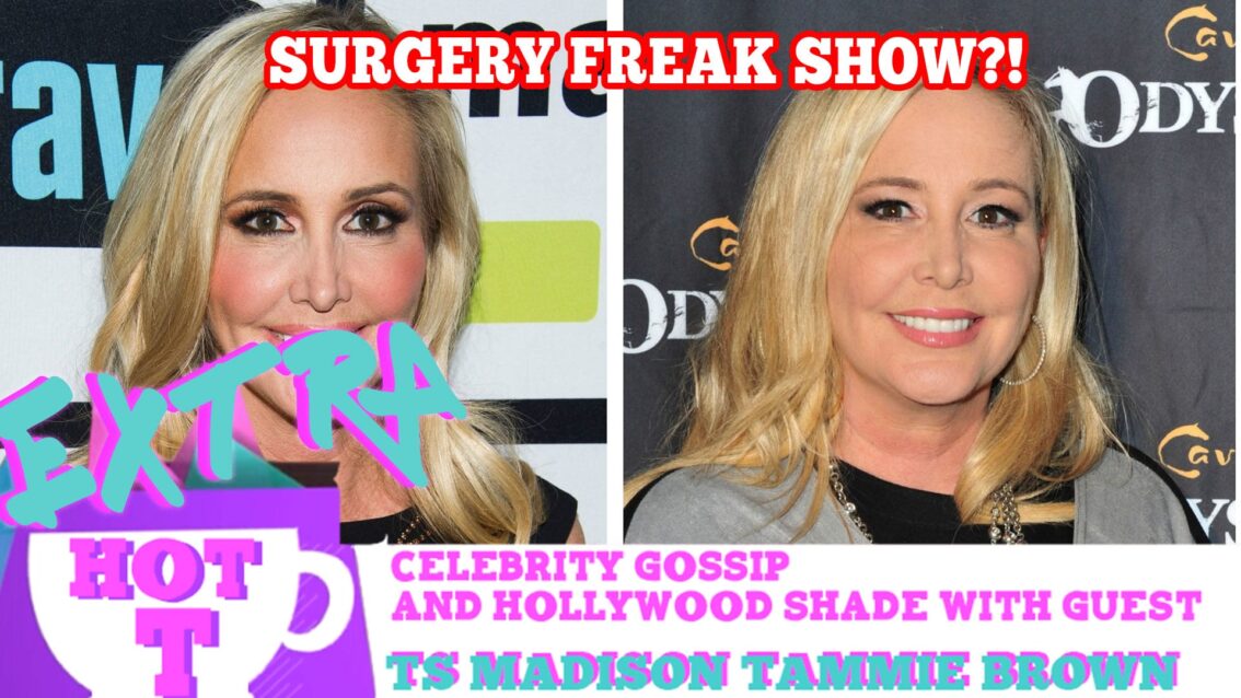 Real Housewife Plastic Surgery Freak Show?: Extra Hot T with TAMMIE BROWN & TS MADISON